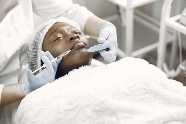 Dermal filler injection near lips