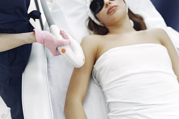 Laser hair removal treatment